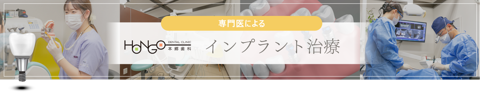 専門医によるインプラント治療